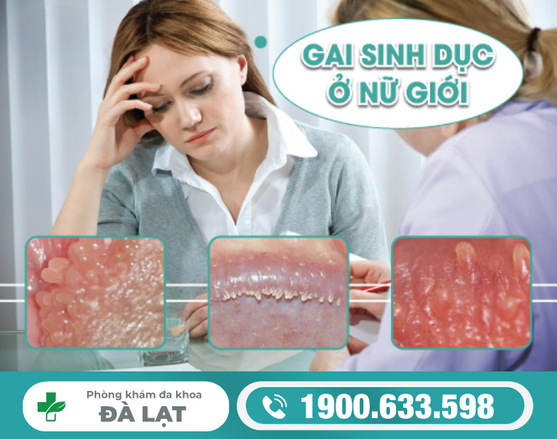 Hình ảnh minh họa